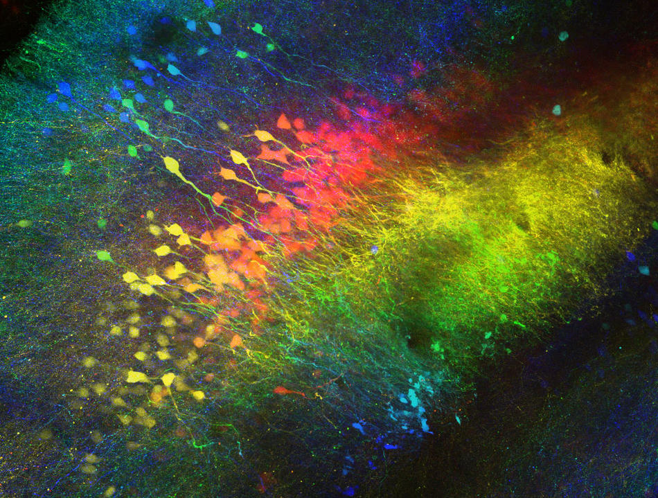 Image of mouse brain cells from the lab of Steven A. Siegelbaum