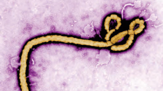 Ebola virus