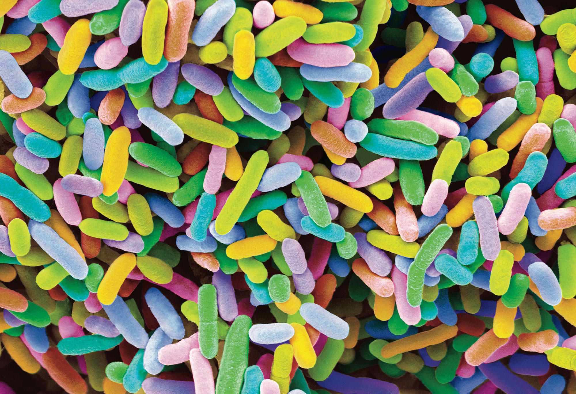 E coli microbes