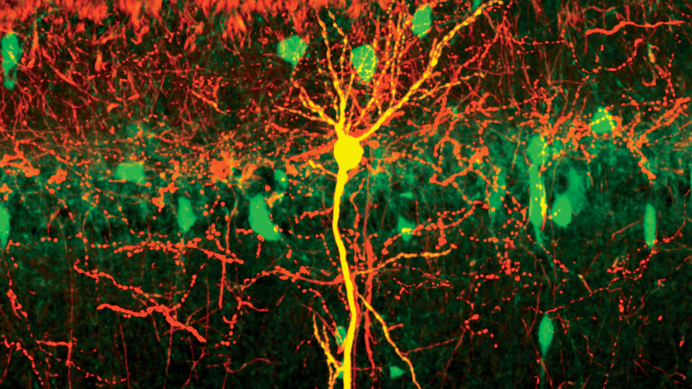 Scan of neurons in the hippocampus