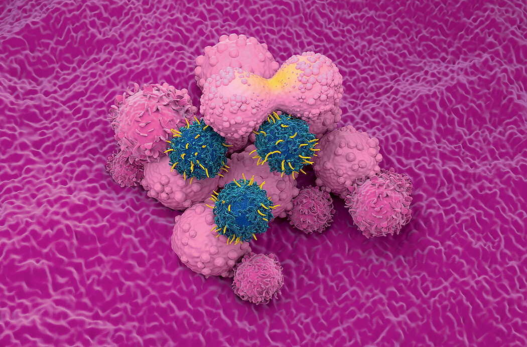 Artist rendering of genetically modified immune cells (blue) attacking cancer
