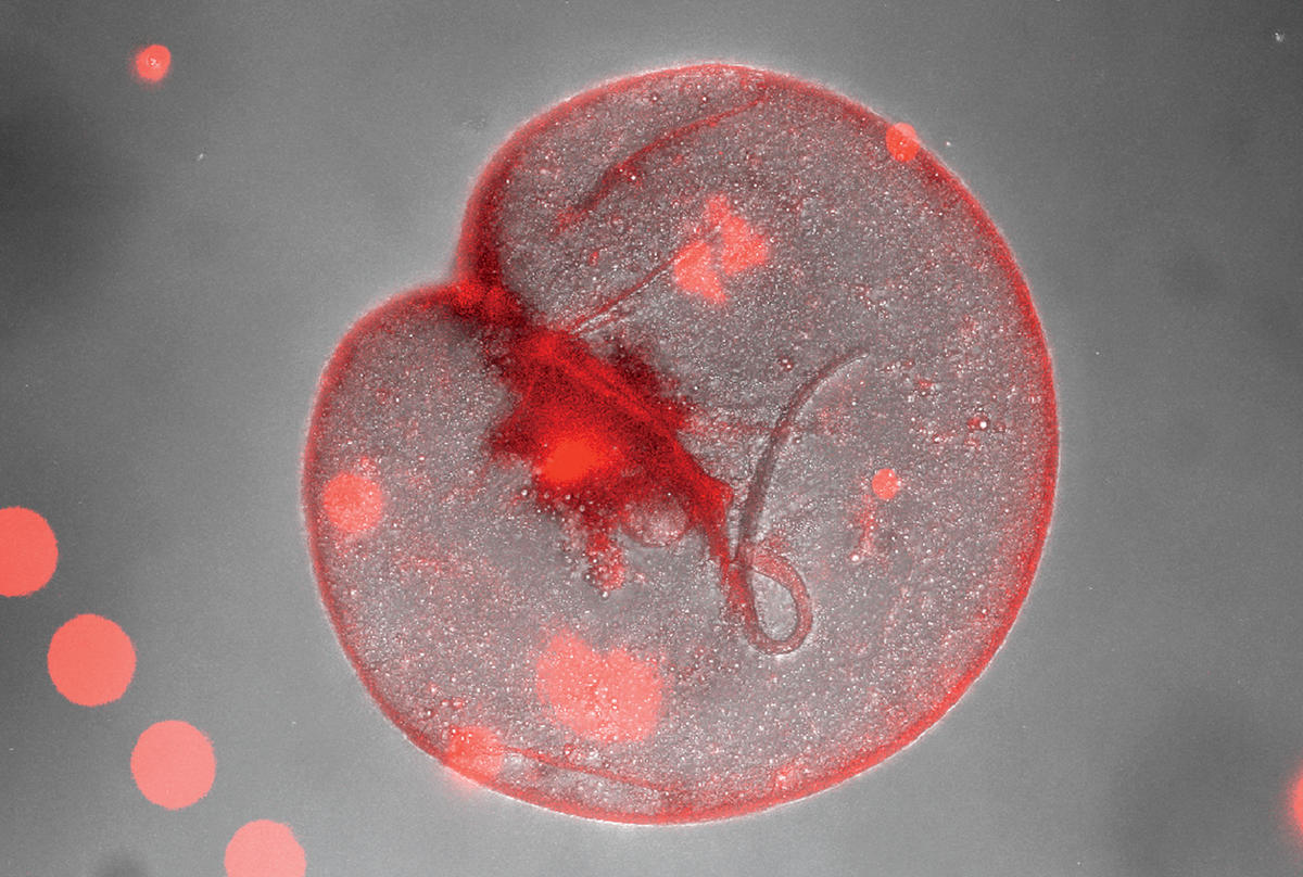 Algae