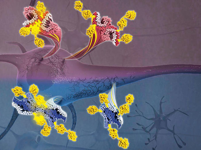 An artist’s rendering of protein accumulations inside a brain cell