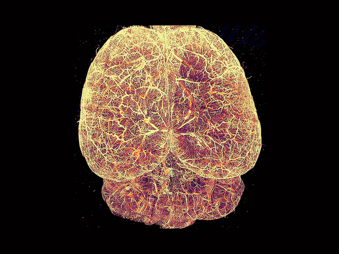3D scan of mouse brain vasculature