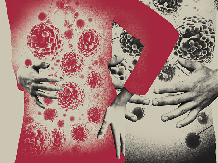 Illustration by Joan Wong representing cancer in young people