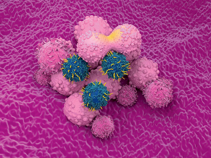Artist rendering of genetically modified immune cells (blue) attacking cancer