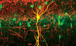 Scan of neurons in the hippocampus 