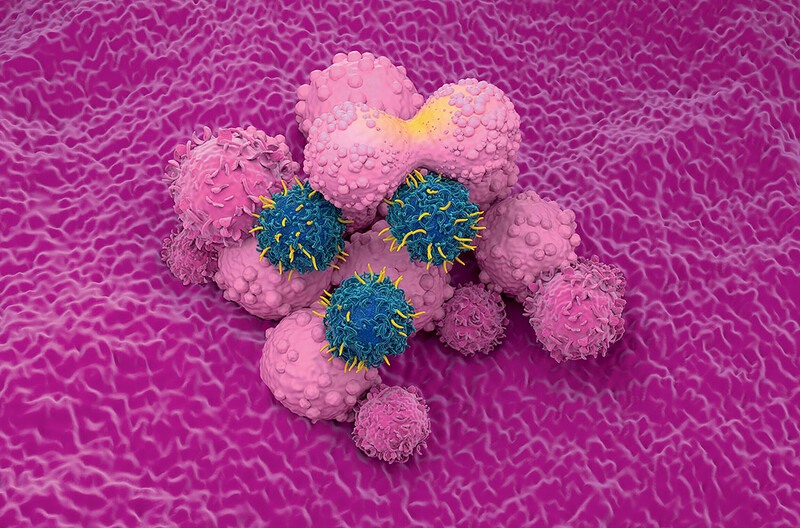 Artist rendering of genetically modified immune cells (blue) attacking cancer