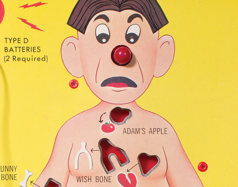"Operation" board game