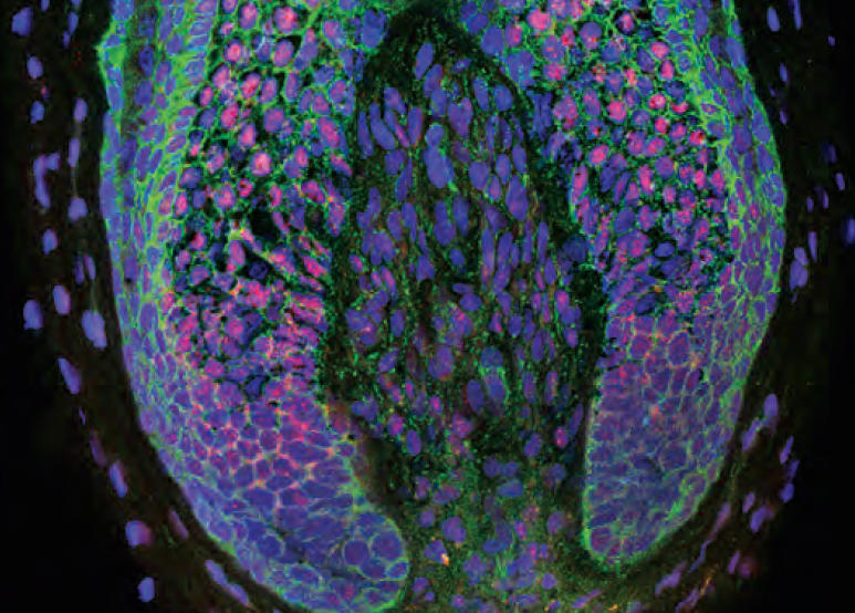 Hair-Regeneration Method the First to Grow New Follicles | Columbia Magazine Hair-Regeneration Method the First to Grow New Follicles | Columbia Magazine