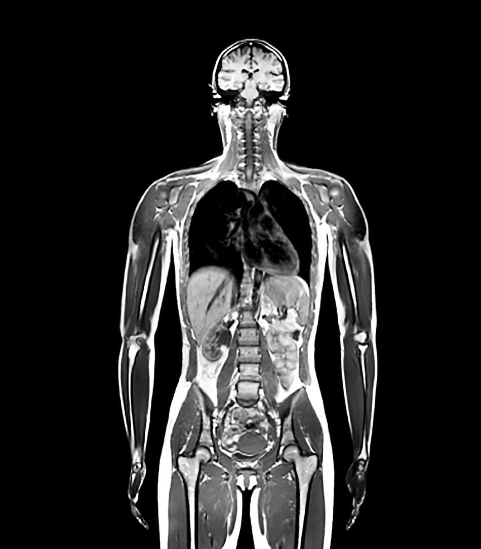 MRI scan of human body