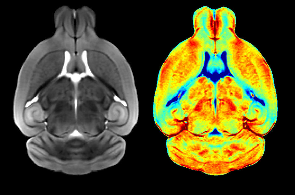 Scans of a mouse brain