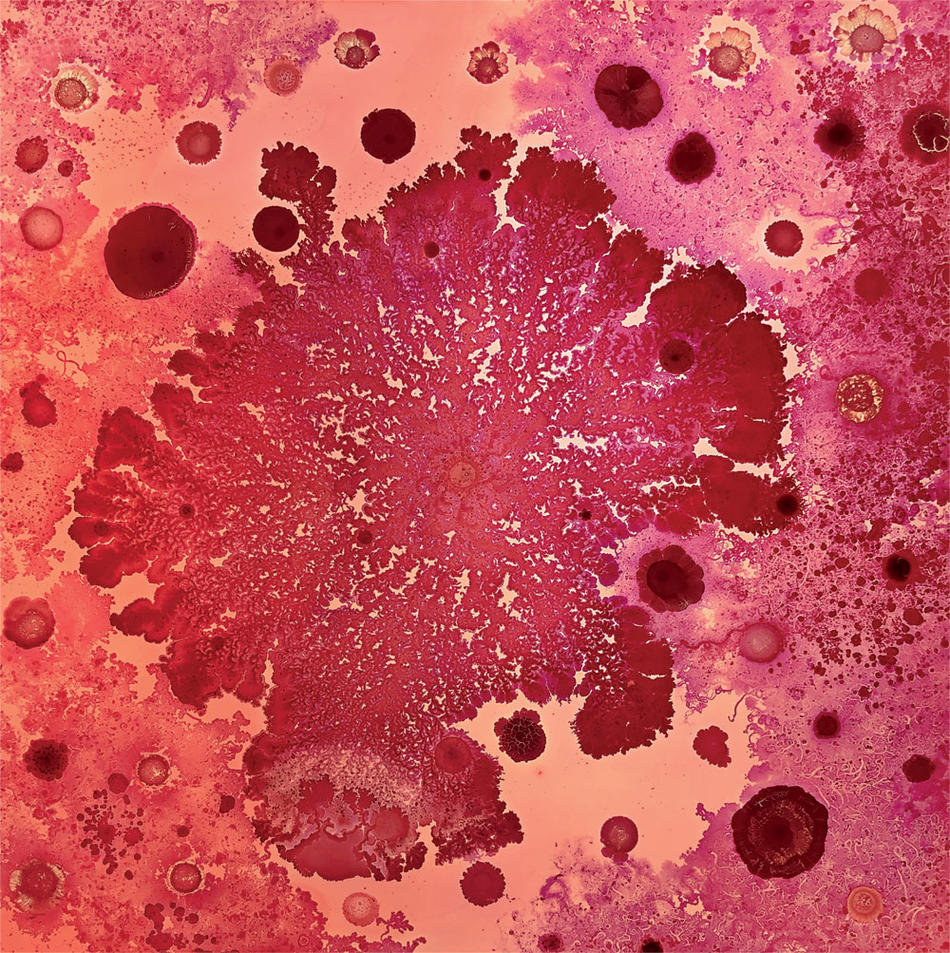 "Coexistence (detail)," 2019. Art made from bacteria by Columbia biomedical engineer Tal Danino.