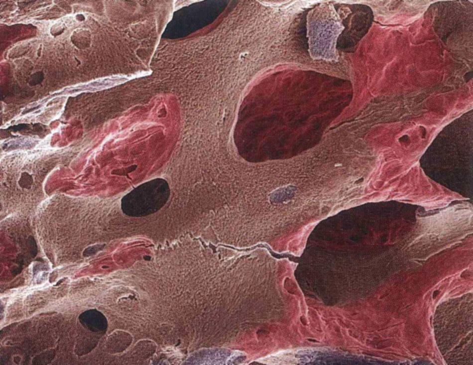 Bone tissue close-up