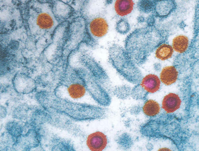 HIV virus particles