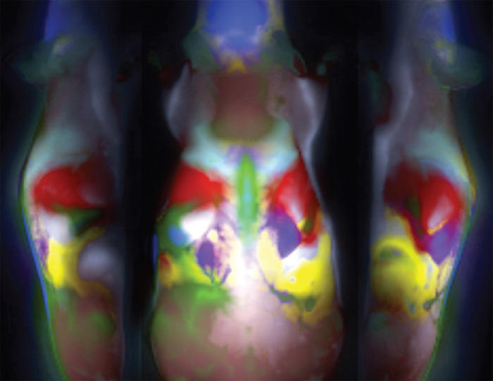 in vivo imaging technology showing color-coded maps of a mouse's innards
